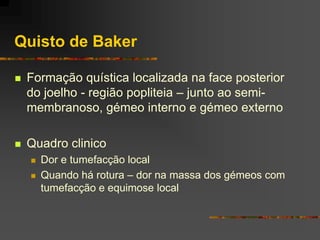 Quisto de Baker

   Formação quística localizada na face posterior
    do joelho - região popliteia – junto ao semi-
    membranoso, gémeo interno e gémeo externo

   Quadro clinico
       Dor e tumefacção local
       Quando há rotura – dor na massa dos gémeos com
        tumefacção e equimose local
 
