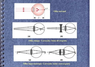 Olho normal




     Olho míope Correção: lente divergente




Olho hipermétrope Correção: lente convergente
 