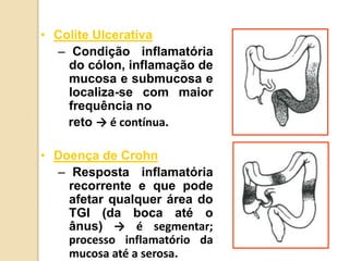 • Colite Ulcerativa
– Condição inflamatória
do cólon, inflamação de
mucosa e submucosa e
localiza-se com maior
frequência no
reto → é contínua.
• Doença de Crohn
– Resposta inflamatória
recorrente e que pode
afetar qualquer área do
TGI (da boca até o
ânus) → é segmentar;
processo inflamatório da
mucosa até a serosa.
 