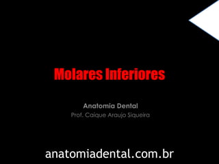 Molares Inferiores 
Anatomia Dental 
Prof. Caíque Araujo Siqueira 
anatomiadental.com.br 
 