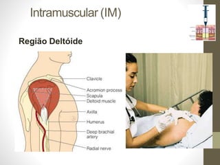 Intramuscular (IM)
Região Deltóide
 