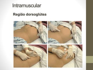 Intramuscular
Região dorsoglútea
 