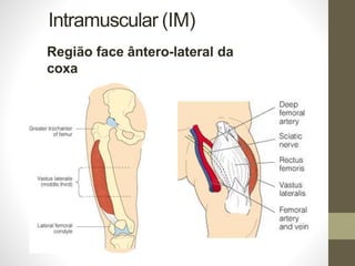 Intramuscular (IM)
Região face ântero-lateral da
coxa
 
