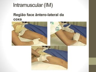 Intramuscular (IM)
Região face ântero-lateral da
coxa
 