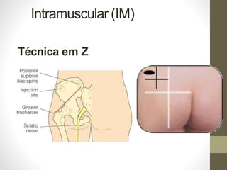 Intramuscular (IM)
Técnica em Z
 
