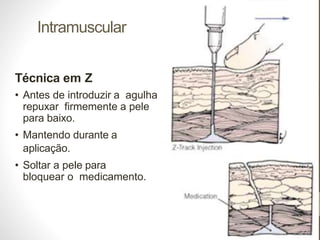Intramuscular
Técnica em Z
• Antes de introduzir a agulha
repuxar firmemente a pele
para baixo.
• Mantendo durante a
aplicação.
• Soltar a pele para
bloquear o medicamento.
 