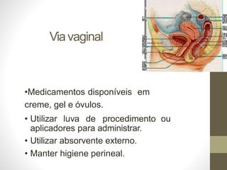 Viavaginal
•Medicamentos disponíveis em
creme, gel e óvulos.
• Utilizar luva de procedimento ou
aplicadores para administrar.
• Utilizar absorvente externo.
• Manter higiene perineal.
 