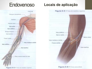 Endovenoso Locais de aplicação
 