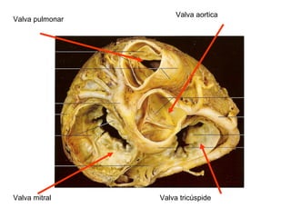 Valva pulmonar
Valva aortica
Valva mitral Valva tricúspide
 