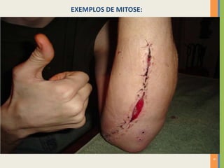 EXEMPLOS DE MITOSE:

6

 