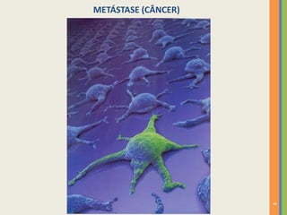 METÁSTASE (CÂNCER)

8

 