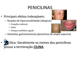 PENICILINAS
• Principais efeitos Indesejáveis:
– Reações de hipersensibilidade (alérgicas)
• Erupções cutâneas
• Febre
• Choque anafilático agudo
– Distúrbios gastrointestinais (penicilinas de amplo espectro)
• Dica: Geralmente os nomes das penicilinas
possui a terminação CILINA.
 