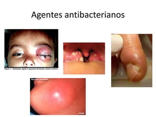Agentes antibacterianos
 
