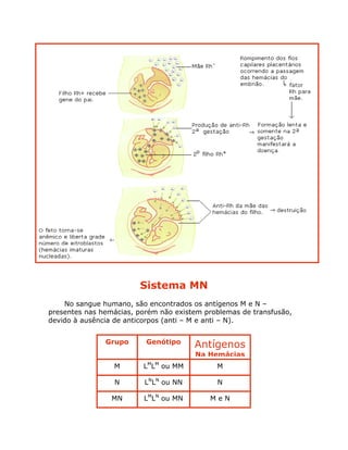 Sistema MN
No sangue humano, são encontrados os antígenos M e N –
presentes nas hemácias, porém não existem problemas de transfusão,
devido à ausência de anticorpos (anti – M e anti – N).
Grupo Genótipo
Antígenos
Na Hemácias
M
N
MN
LM
LM
ou MM M
LN
LN
ou NN
LM
LN
ou MN
N
M e N
 