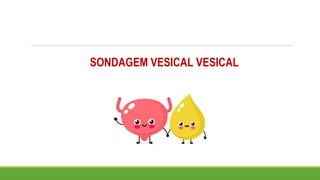 SONDAGEM VESICAL VESICAL
 