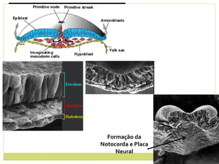 Formação da
Notocorda e Placa
Neural
 