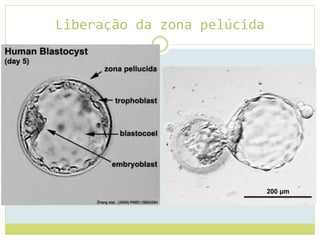 Liberação da zona pelúcida
 
