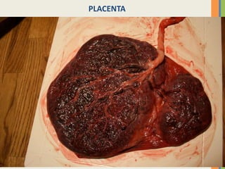 PLACENTA

 
