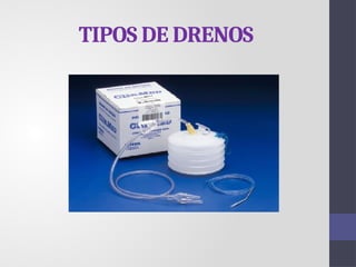 TIPOS DE DRENOS
 