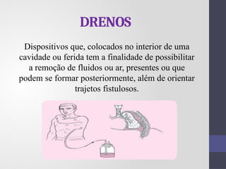 DRENOS
Dispositivos que, colocados no interior de uma
cavidade ou ferida tem a finalidade de possibilitar
a remoção de fluidos ou ar, presentes ou que
podem se formar posteriormente, além de orientar
trajetos fistulosos.
 