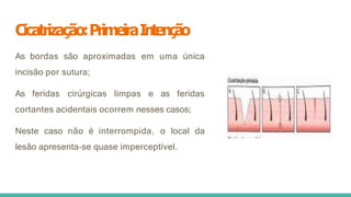 Cicatrização:PrimeiraIntenção
As bordas são aproximadas em uma única
incisão por sutura;
As feridas cirúrgicas limpas e as feridas
cortantes acidentais ocorrem nesses casos;
Neste caso não é interrompida, o local da
lesão apresenta-se quase imperceptível.
 