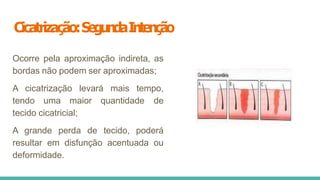 Cicatrização:SegundaIntenção
Ocorre pela aproximação indireta, as
bordas não podem ser aproximadas;
A cicatrização levará mais tempo,
tendo uma maior quantidade de
tecido cicatricial;
A grande perda de tecido, poderá
resultar em disfunção acentuada ou
deformidade.
 