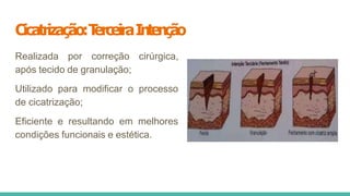Cicatrização:T
erceiraIntenção
Realizada por correção cirúrgica,
após tecido de granulação;
Utilizado para modificar o processo
de cicatrização;
Eficiente e resultando em melhores
condições funcionais e estética.
 