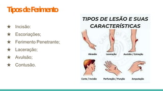 TiposdeFerimento
★ Incisão:
★ Escoriações;
★ Ferimento Penetrante;
★ Laceração;
★ Avulsão;
★ Contusão.
 