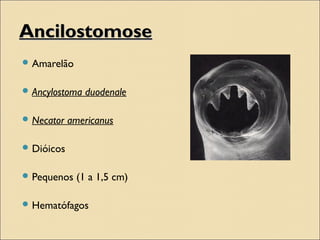 AncilostomoseAncilostomose
 Amarelão
 Ancylostoma duodenale
 Necator americanus
 Dióicos
 Pequenos (1 a 1,5 cm)
 Hematófagos
 