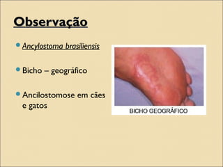 ObservaçãoObservação
Ancylostoma brasiliensis
Bicho – geográfico
Ancilostomose em cães
e gatos
 