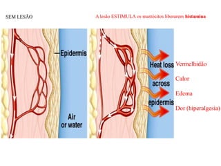 Vermelhidão
Calor
Edema
Dor (hiperalgesia)
A lesão ESTIMULA os mastócitos liberarem histamina
SEM LESÃO
 