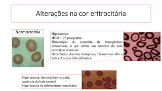 Alterações na cor eritrocitária
Normocromia Hipocromia:
HCM < 27 picograma.
Diminuição do conteúdo de hemoglobina
eritrocitária, o que reflete um aumento do halo
central do eritrócito.
Ocorrência: Anemia ferropriva, Talassemias alfa e
beta e Anemia Sideroblástica.
Hipercromia: hemácia bem corada,
ausência do halo central.
Hipercromia na esferocitose hereditária
 