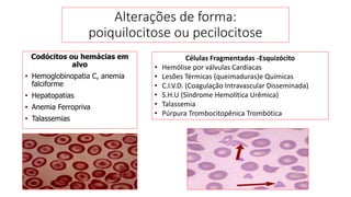 Codócitos ou hemácias em
alvo
• Hemoglobinopatia C, anemia
falciforme
• Hepatopatias
• Anemia Ferropriva
• Talassemias
Alterações de forma:
poiquilocitose ou pecilocitose
Células Fragmentadas -Esquizócito
• Hemólise por válvulas Cardíacas
• Lesões Térmicas (queimaduras)e Químicas
• C.I.V.D. (Coagulação Intravascular Disseminada)
• S.H.U (Síndrome Hemolítica Urêmica)
• Talassemia
• Púrpura Trombocitopênica Trombótica
 