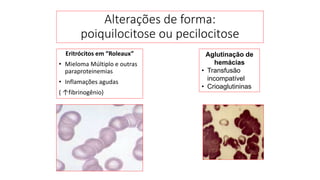 Eritrócitos em “Roleaux”
• Mieloma Múltiplo e outras
paraproteinemias
• Inflamações agudas
( ↑fibrinogênio)
Alterações de forma:
poiquilocitose ou pecilocitose
Aglutinação de
hemácias
• Transfusão
incompatível
• Crioaglutininas
 