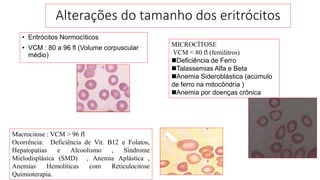 Alterações do tamanho dos eritrócitos
• Eritrócitos Normocíticos
• VCM : 80 a 96 fl (Volume corpuscular
médio)
MICROCÍTOSE
VCM < 80 fl (fentilitros)
Deficiência de Ferro
Talassemias Alfa e Beta
Anemia Sideroblástica (acúmulo
de ferro na mitocôndria )
Anemia por doenças crônica
Macrocitose : VCM > 96 fl
Ocorrência: Deficiência de Vit. B12 e Folatos,
Hepatopatias e Alcoolismo , Síndrome
Mielodisplásica (SMD) , Anemia Aplástica ,
Anemias Hemolíticas com Reticulocitose
Quimioterapia.
 