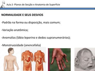 NORMALIDADE E SEUS DESVIOS
-Padrão na forma ou disposição, mais comum;
-Variação anatômica;
-Anomalias (lábio leporino e dedos supranumerários);
-Monstruosidade (anencefalia)
Aula 2- Planos de Secção e Anatomia de Superfície
 