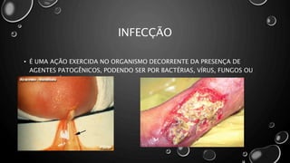 INFECÇÃO
• É UMA AÇÃO EXERCIDA NO ORGANISMO DECORRENTE DA PRESENÇA DE
AGENTES PATOGÊNICOS, PODENDO SER POR BACTÉRIAS, VÍRUS, FUNGOS OU
PROTOZOÁRIOS.
 