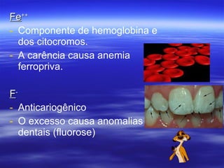 Fe ++ Componente de hemoglobina e dos citocromos.  A carência causa anemia ferropriva. F - Anticariogênico O excesso causa anomalias dentais (fluorose) 
