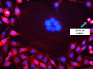  Cromossomos Autossomos: são os
22 pares de cromossomos (humanos
por exemplo) não sexuais.
 Cromossomos Heterossomos:
determinam a característica sexual ( 1
par nos humanos) XX (feminino) XY
(masculino).
 