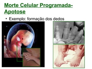 Morte Celular Programada-
Apotose
• Exemplo: formação dos dedos
 