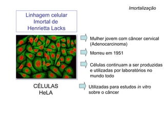 Linhagem celular
Imortal de
Henrietta Lacks
Mulher jovem com câncer cervical
(Adenocarcinoma)
Morreu em 1951
Células continuam a ser produzidas
e utilizadas por laboratórios no
mundo todo
CÉLULAS
HeLA
Utilizadas para estudos in vitro
sobre o câncer
Imortalização
 