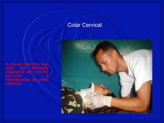 O COLAR CERVICAL NÃO 
DEVE SER RETIRADO 
ENQUANTO NÃO ESTIVER 
EXCLUÍDA A 
POSSIBILIDADE DE LESÃO 
CERVICAL. 
Colar Cervical 
 