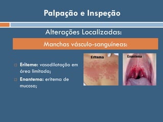 Palpação e Inspeção
 Eritema: vasodilatação em
área limitada;
 Enantema: eritema de
mucosa;
Manchas vásculo-sanguíneas:
Alterações Localizadas:
 