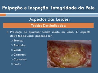 Palpação e Inspeção: Integridade da Pele
 Presença de qualquer tecido morto na lesão. O aspecto
deste tecido varia, podendo ser:
 Branco;
 Amarelo;
 Verde;
 Cinzento;
 Castanho;
 Preto.
Aspectos das Lesões:
Tecidos Desvitalizados:
 