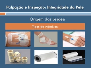 Palpação e Inspeção: Integridade da Pele
Origem das Lesões:
Tipos de Adesivos:
 