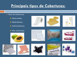 Principais tipos de Coberturas:
 Tipos de Coberturas:
 Absorventes;
 Desbridantes;
 Antimicrobianos;
 Não aderentes;
 