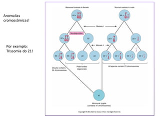 Anomalias	
cromossômicas!
Por	exemplo:
Trissomia	do	21!
 