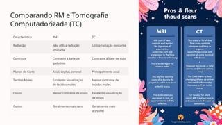 Comparando RM e Tomografia
Computadorizada (TC)
Característica RM TC
Radiação Não utiliza radiação
ionizante
Utiliza radiação ionizante
Contraste Contraste à base de
gadolínio
Contraste à base de iodo
Planos de Corte Axial, sagital, coronal Principalmente axial
Tecidos Moles Excelente visualização
de tecidos moles
Menor contraste de
tecidos moles
Ossos Menor contraste de ossos Excelente visualização
de ossos
Custos Geralmente mais caro Geralmente mais
acessível
 