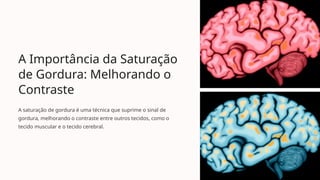 A Importância da Saturação
de Gordura: Melhorando o
Contraste
A saturação de gordura é uma técnica que suprime o sinal de
gordura, melhorando o contraste entre outros tecidos, como o
tecido muscular e o tecido cerebral.
 