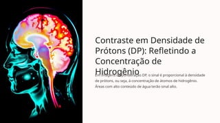 Contraste em Densidade de
Prótons (DP): Refletindo a
Concentração de
Hidrogênio
Em imagens de ponderação DP, o sinal é proporcional à densidade
de prótons, ou seja, à concentração de átomos de hidrogênio.
Áreas com alto conteúdo de água terão sinal alto.
 